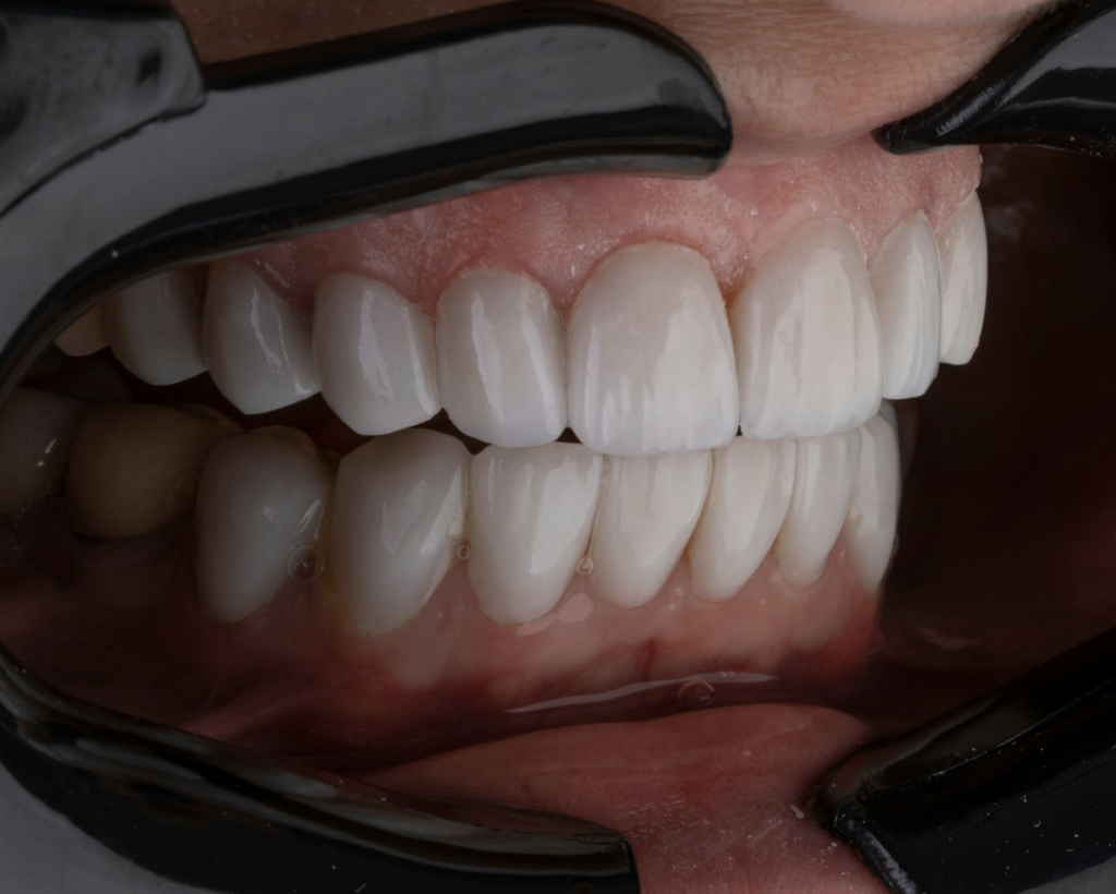 teeth-close-up-dental-checkup